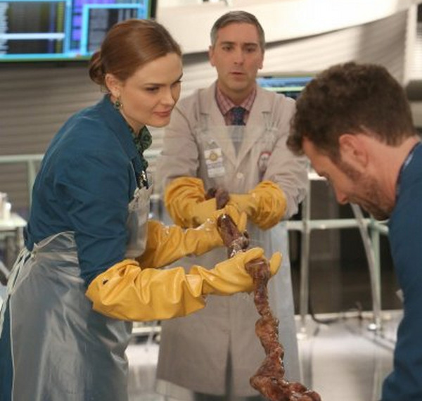 Bones 9x14